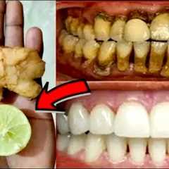 Teeth Whitening at Home in 3 Minutes || How to Whiten your Yellow Teeth || 100% effective