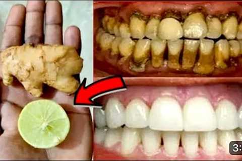 Teeth Whitening at Home in 3 Minutes || How to Whiten your Yellow Teeth || 100% effective