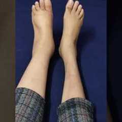 Exercises to reduce swelling in Feet । Reduce swelling in Lymphedema । #shorts