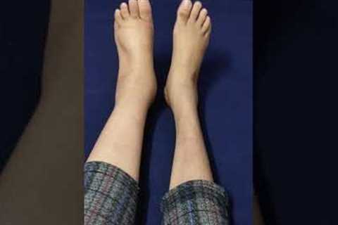 Exercises to reduce swelling in Feet । Reduce swelling in Lymphedema । #shorts